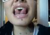 Tongue