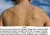 The truth about gingers
