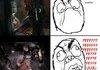 Playing on Zealot