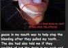 Protect your teeth