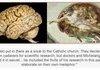 Brain