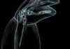 X-Ray of Kermit the Frog