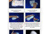 Another forever alone kit