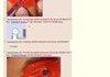 4chan Anticancer