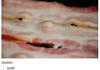 pls
