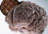 Scumbag brain