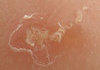 Ice lake on mars