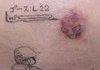 a wild bruise appeared