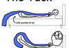 True story