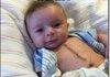 Ridiculously Photogenic Surgery <b>Baby</b>