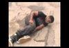 BMX fail broken leg