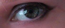 I Have Like Green Grey Eyes With A Dark Grey Ring Added By Anonymous At How To Tell If Your Adopted